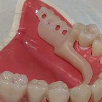 Изберете нашите базални импланти 34 от MedicalDent Изберете нашите базални импланти 34