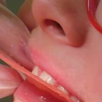 Огромно разнообразие от базални импланти 8 от MedicalDent Огромно разнообразие от базални импланти 8