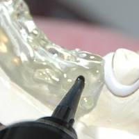 Най-добрите оферти за имплантология 7 от MedicalDent Най-добрите оферти за имплантология 7