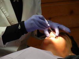 Видове избелване на зъби 12