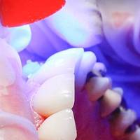 Голямо разнообразие зъбни протези 17