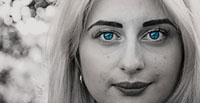 Разновидности премахване на целулит 24 - DermaVita Разновидности премахване на целулит 24