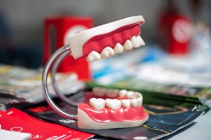 Find the best deals on Dental Implants 37