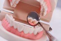зъбен мост - 7066 - научете повече
