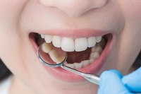 зъболекар Русе - 7679 - качествени продукти
