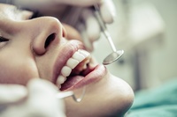 зъболекар Русе - 27887 - изберете най-добрите