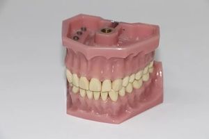 болки в зъба - 7918 типа