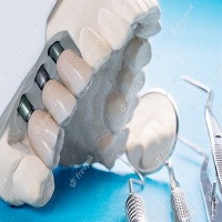 зъбни импланти - 11568 снимки