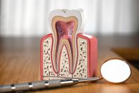 избелващи ленти за зъби - 15349 клиенти