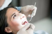 избелване на зъби в домашни условия - 76972 цени